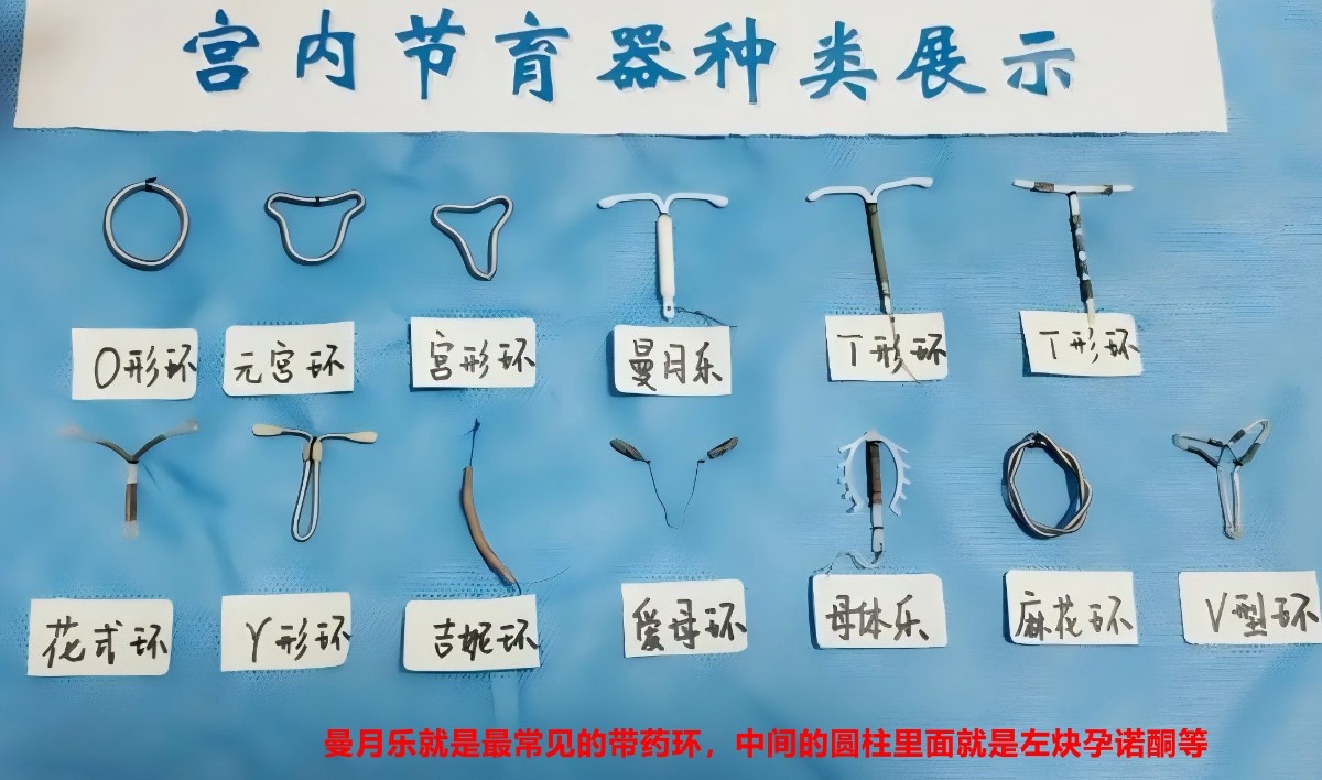 主流节育环.jpg